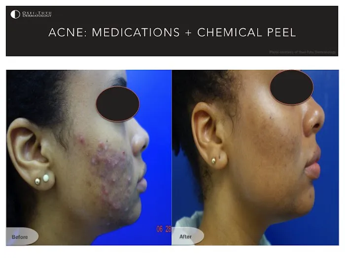 Osei-Tutu Dermatology & Hair Restoration Picture 10