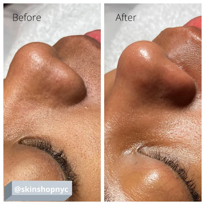 Skin Shop NYC Picture 7