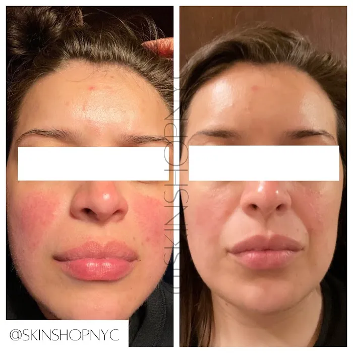 Skin Shop NYC Picture 6