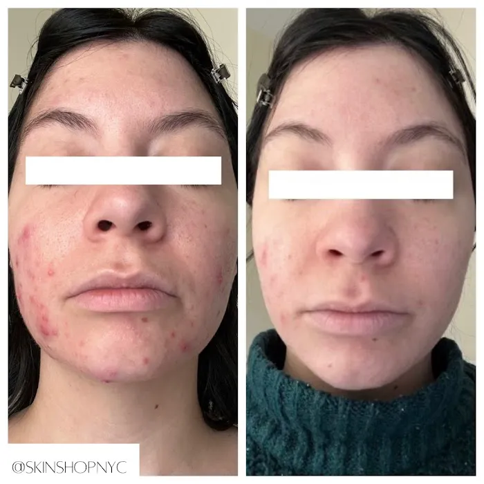 Skin Shop NYC Picture 8