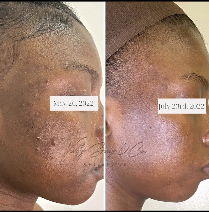 Vivify Body & Co. Picture 2