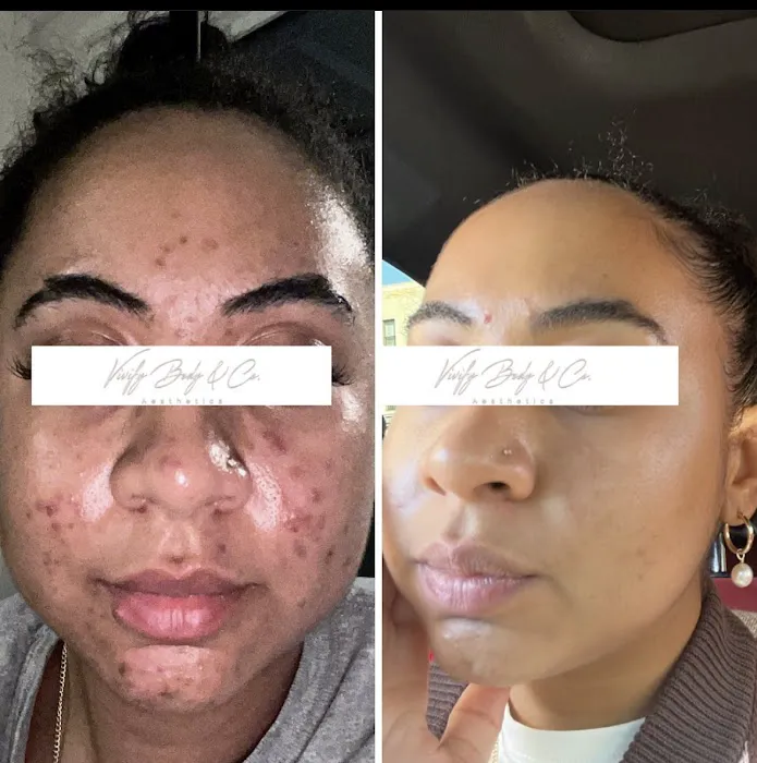 Vivify Body & Co. Picture 4