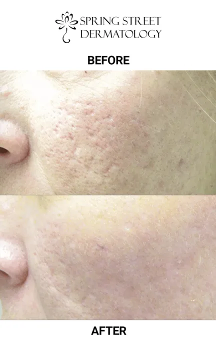 Spring Street Dermatology - SOHO Picture 9