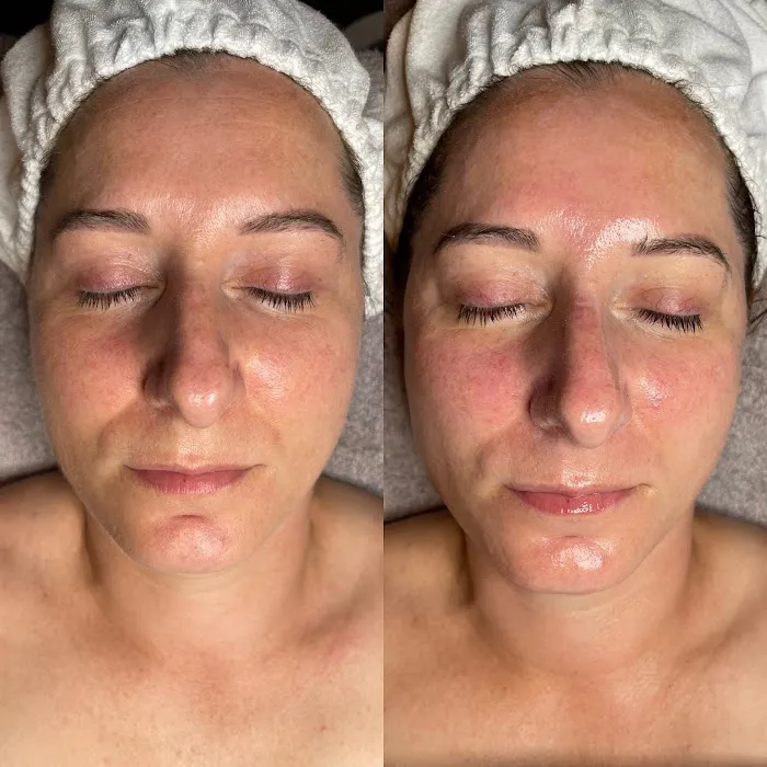 Jillian Wright Facials Picture 7