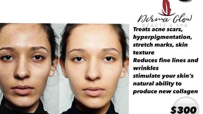 Derma Glow Beauty Spa Picture 3
