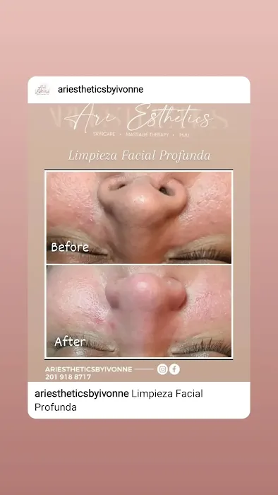 Ari Esthetics by Ivonne NJ Picture 5