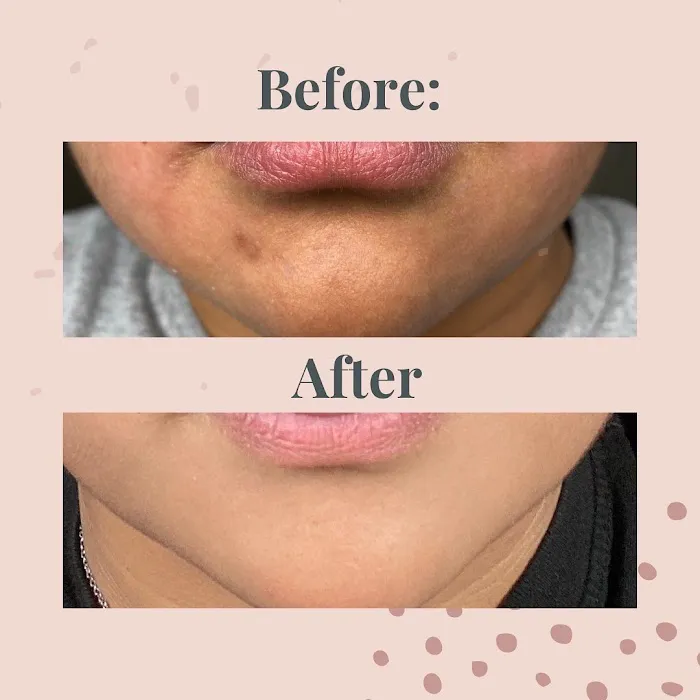 Moonlight Luxury Beauty Picture 5