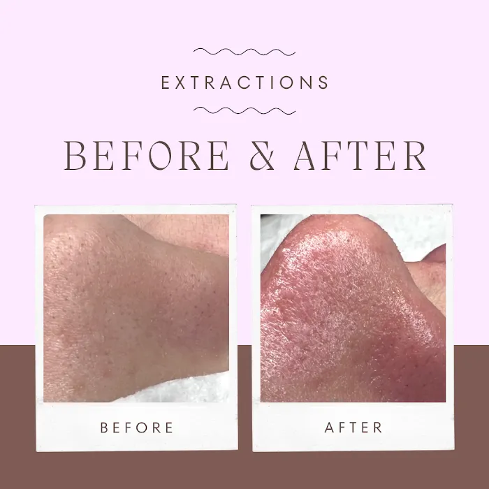 Moonlight Luxury Beauty Picture 6