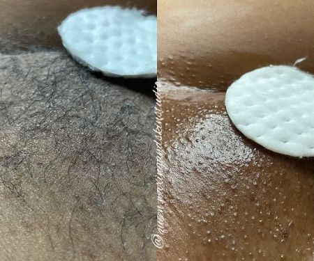 Queen Waxing and Skin