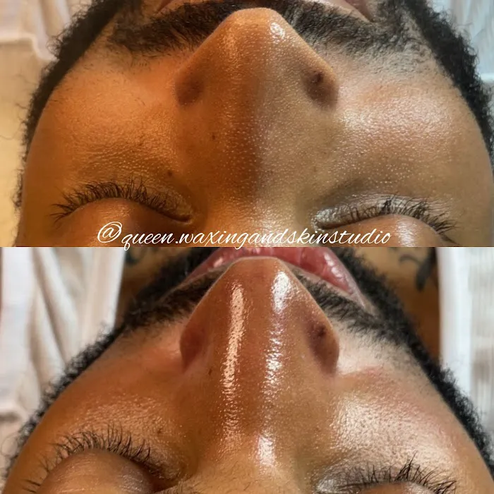 Queen Waxing and Skin Picture 5