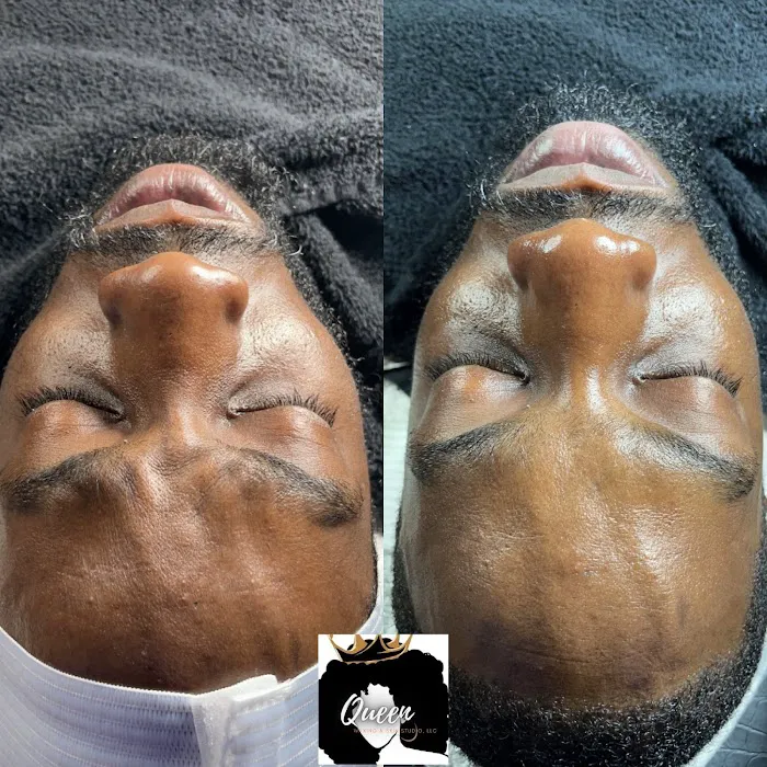 Queen Waxing and Skin Picture 4