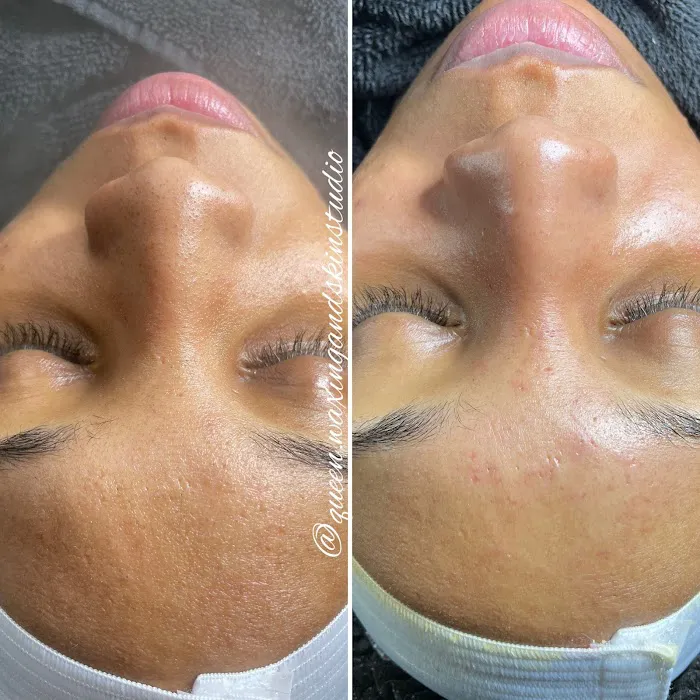 Queen Waxing and Skin Picture 6