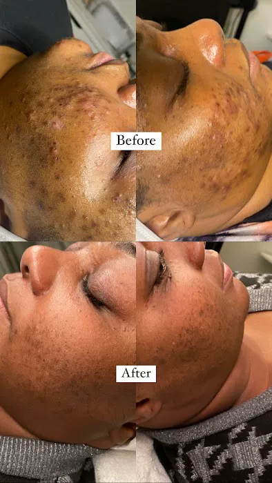 Skinderlust Picture 1