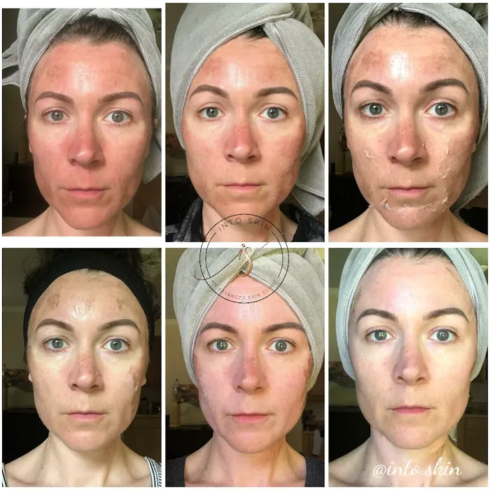 Into Skin Aesthetic Studio Picture 10