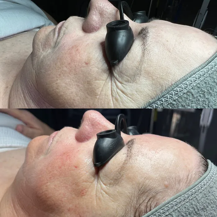 Into Skin Aesthetic Studio Picture 7