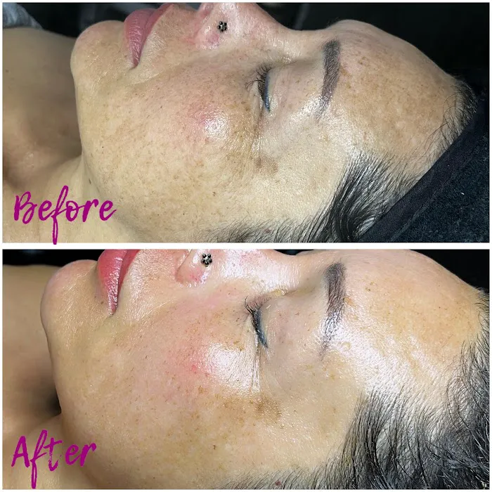 Lushy Skin Picture 10