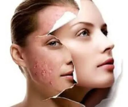 Skinovation Advanced Skincare LLC