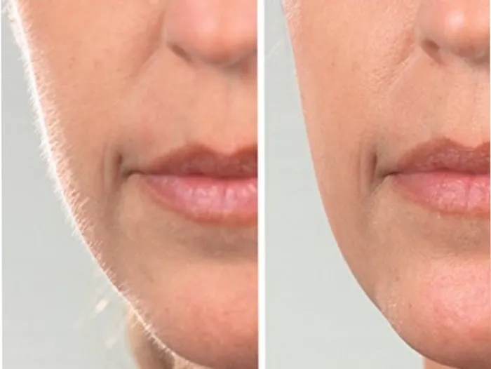 Skinovation Advanced Skincare LLC Picture 3