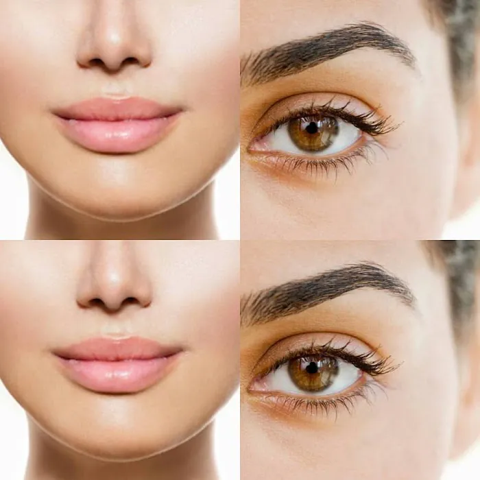 Fresh Face Skincare & Laser Picture 6