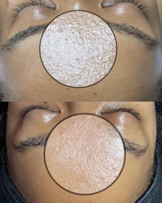 Revise Skin Studio - Poughkeepsie Acne Specialist Picture 6