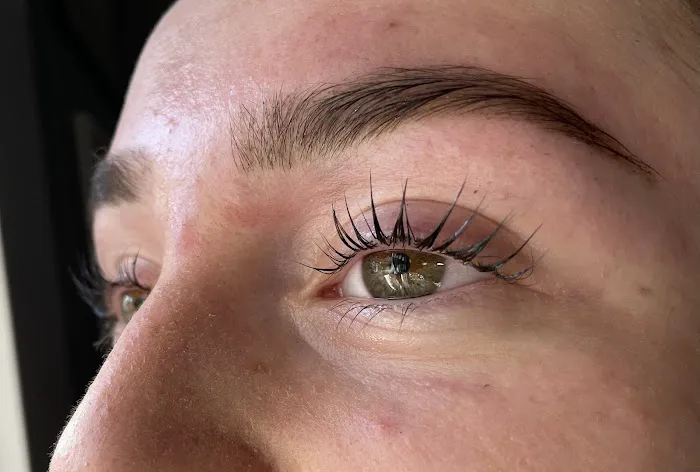 Revise Skin Studio - Poughkeepsie Acne Specialist Picture 7