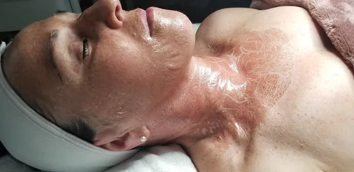 Skin Ritual Picture 3