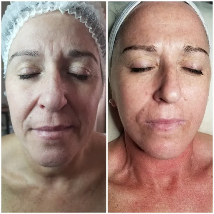 Skin Ritual Picture 5