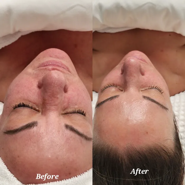 Skin Ritual Picture 8