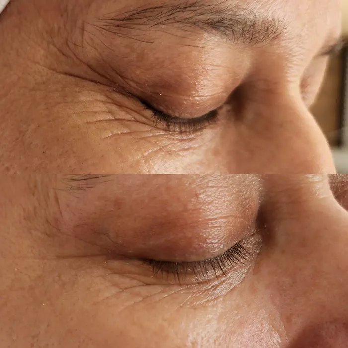 Skin Ritual Picture 7