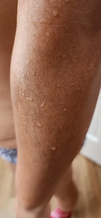 Skin Ritual Picture 10