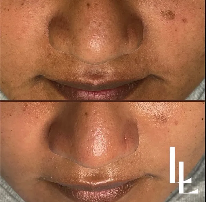 Luisa Lempe Aesthetics Picture 6