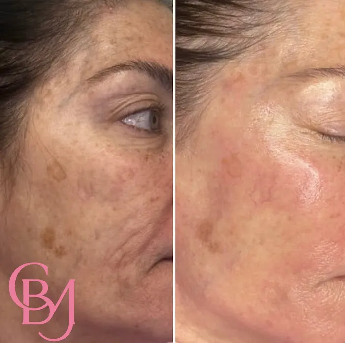 Luisa Lempe Aesthetics Picture 4