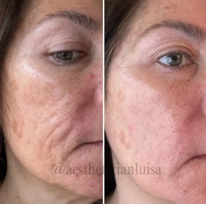 Luisa Lempe Aesthetics Picture 5