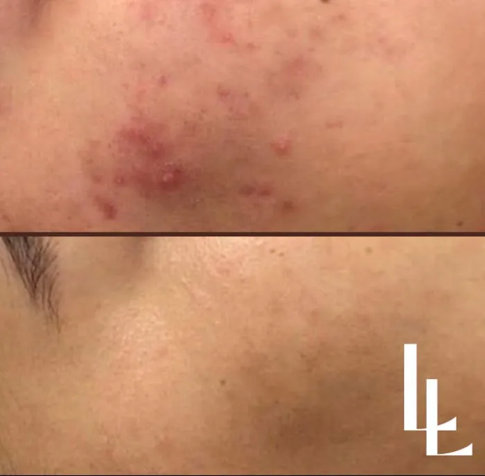 Luisa Lempe Aesthetics Picture 8