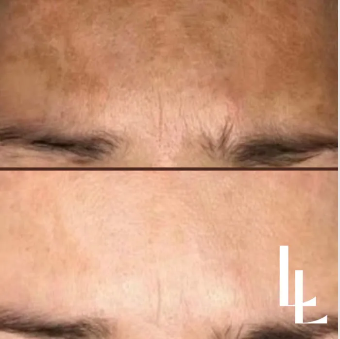 Luisa Lempe Aesthetics Picture 9