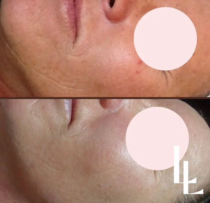 Luisa Lempe Aesthetics Picture 7