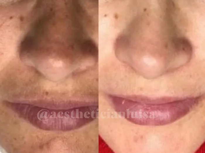 Luisa Lempe Aesthetics Picture 10