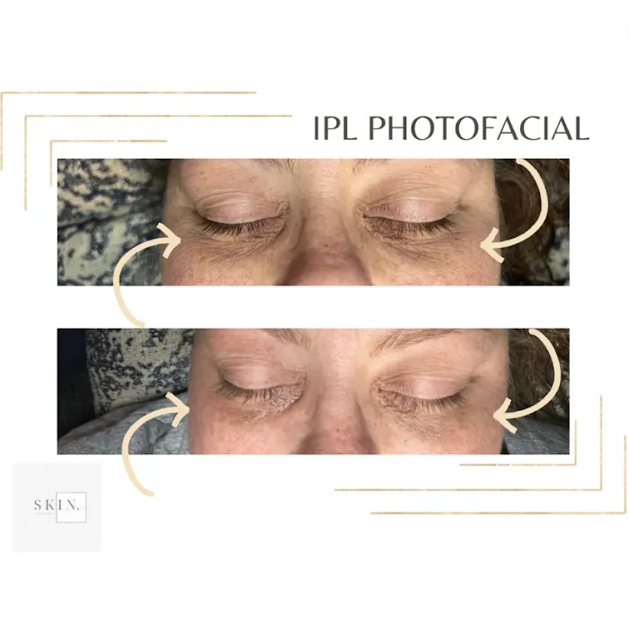 Skin By Claire Picture 6