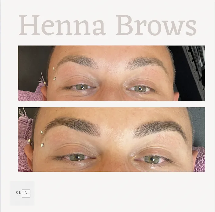 Skin By Claire Picture 5