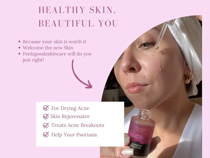 Feelzgoodzskincare Picture 5