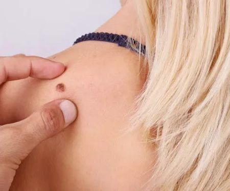 Brooklyn Dermatology Doctor