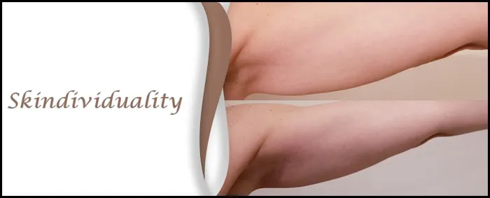 Skindividuality Picture 1