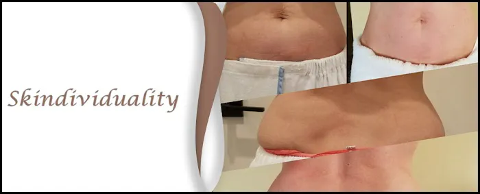 Skindividuality Picture 3