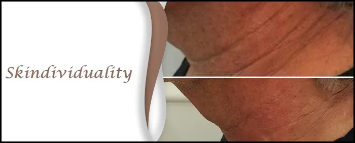 Skindividuality Picture 4