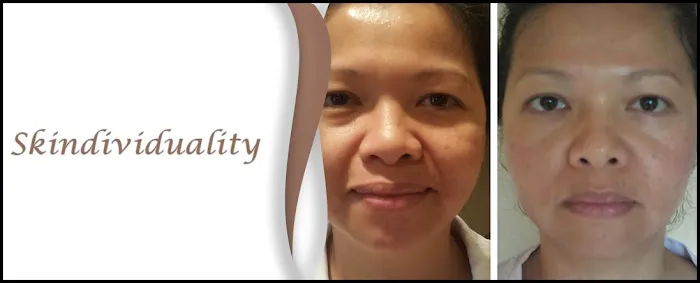 Skindividuality Picture 8