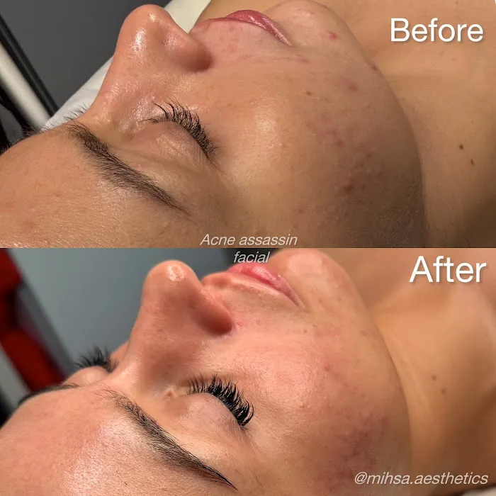 MIHSA Aesthetics Picture 5