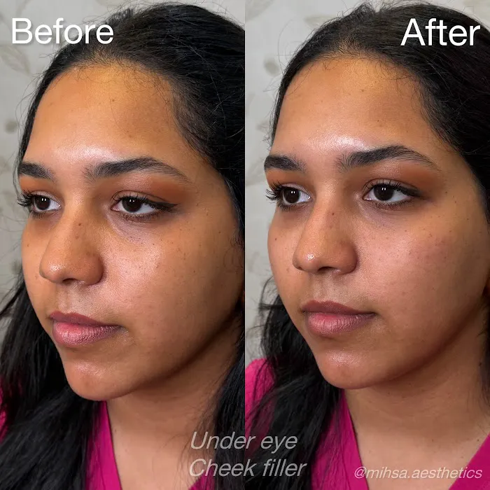 MIHSA Aesthetics Picture 6