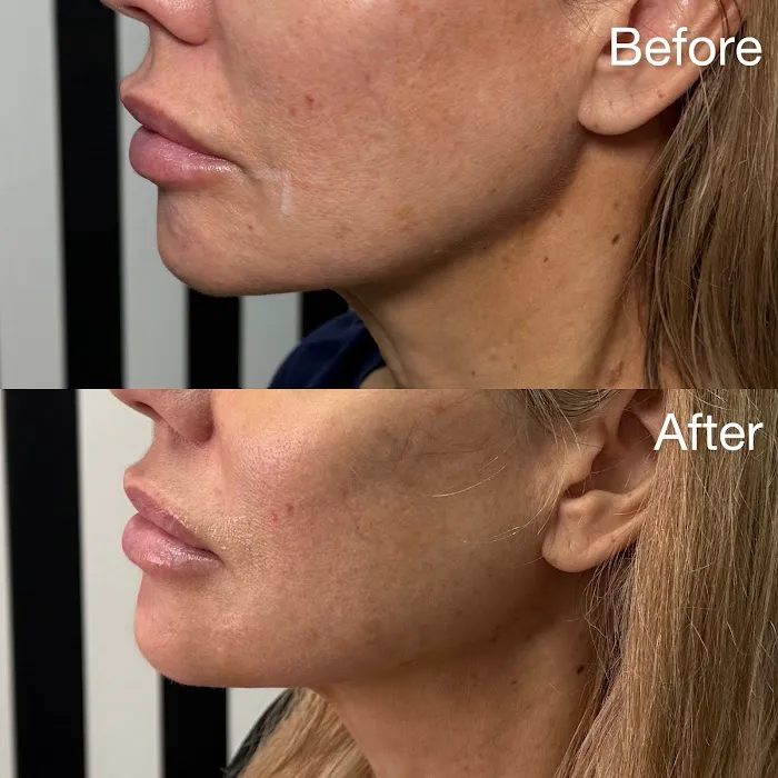 MIHSA Aesthetics Picture 7