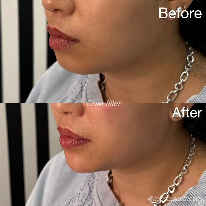 MIHSA Aesthetics Picture 8