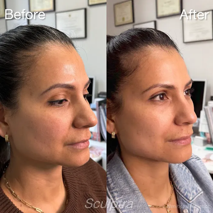 MIHSA Aesthetics Picture 9